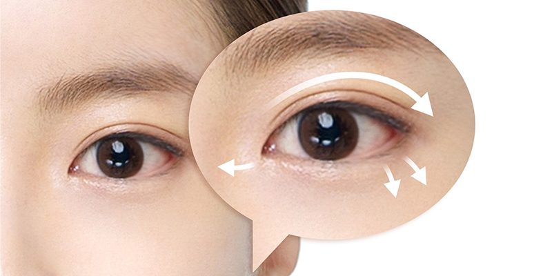 Những điều bạn cần biết khi thực hiện phẫu thuật cắt mí mắt