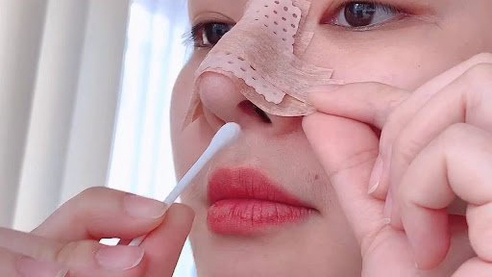 Cách chăm sóc và vệ sinh mũi sau phẫu thuật nâng mũi